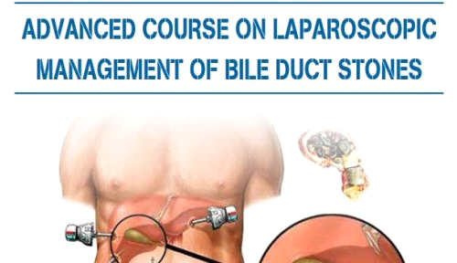 (04/10/2018) CME: Phẫu thuật nội soi điều trị sỏi mật