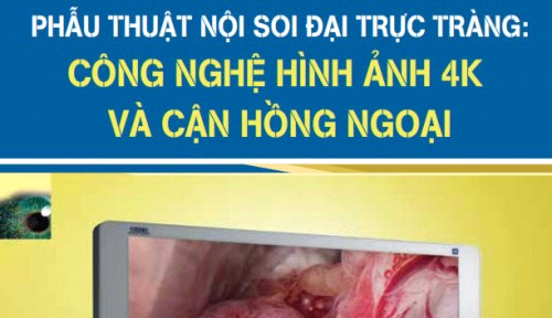 (04/10/2018) Phẫu thuật nội soi Đại trực tràng